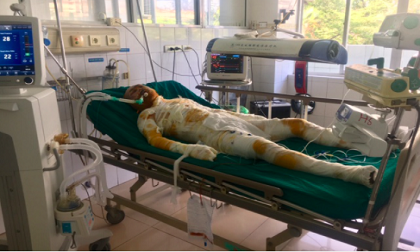 Vụ phóng hỏa đốt nhà người tình ở Sơn La: Các nạn nhân đang rất nguy kịch